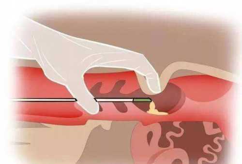 雌二醇水平波动？这些影响你必须知道