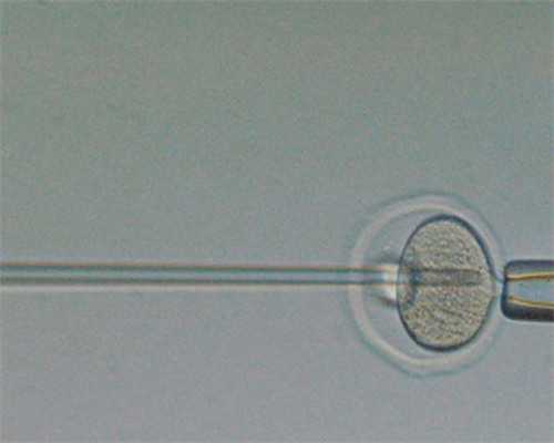 跨国求子攻略：全球十大PGD权威机构盘点