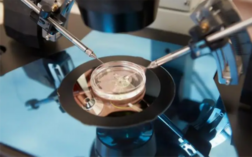 石家庄二代试管精子优选技术革新进展