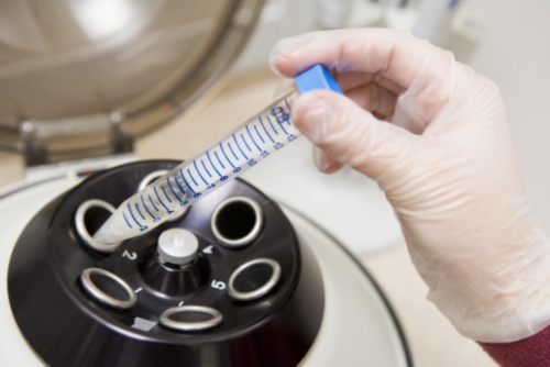 试管失败别放弃！二次OPU如何提升成功率